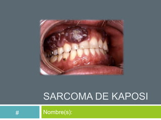 SARCOMA DE KAPOSI
#   Nombre(s):
 