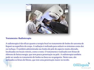 Tratamento: Radioterapia
A radioterapia é tão eficaz quanto a terapia local no tratamento de lesões do sarcoma de
Kaposi na superfície do corpo. A radiação é realizada para reduzir os sintomas como dor
ou inchaço. É também administrada nas lesões de pele de aspecto muito alterado,
localizadas em locais visíveis, como o rosto. O tratamento é realizado com feixes de
elétrons de baixa energia, que tem pouca penetração na pele. A radioterapia também
pode ser usada no tratamento de lesões na boca ou na garganta. Neste caso, são
utilizados os feixes de fótons, que tem uma penetração maior no tecido.
 