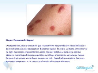 O que é Sarcoma de Kaposi
O sarcoma de Kaposi é um câncer que se desenvolve nas paredes dos vasos linfáticos e
pode simultaneamente aparecer em diferentes regiões do corpo. Costuma apresentar-se
na pele, mas outros órgãos internos, como nódulos linfáticos, pulmões e sistema
digestivo também podem ser acometidos. As células anormais do sarcoma de Kaposi
formam lesões roxas, vermelhas e marrons na pele. Essas lesões na maioria das vezes
aparecem nas pernas ou no rosto e geralmente não causam sintomas.
 