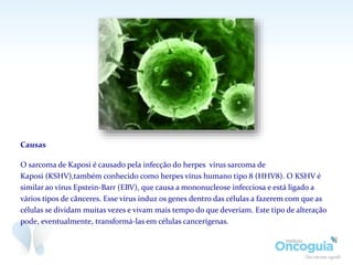 Causas
O sarcoma de Kaposi é causado pela infecção do herpes vírus sarcoma de
Kaposi (KSHV),também conhecido como herpes vírus humano tipo 8 (HHV8). O KSHV é
similar ao vírus Epstein-Barr (EBV), que causa a mononucleose infecciosa e está ligado a
vários tipos de cânceres. Esse vírus induz os genes dentro das células a fazerem com que as
células se dividam muitas vezes e vivam mais tempo do que deveriam. Este tipo de alteração
pode, eventualmente, transformá-las em células cancerígenas.
 