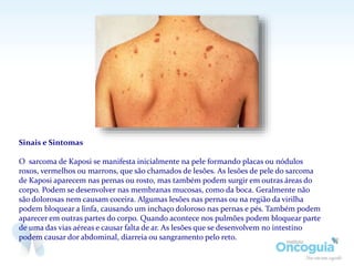 Sinais e Sintomas
O sarcoma de Kaposi se manifesta inicialmente na pele formando placas ou nódulos
roxos, vermelhos ou marrons, que são chamados de lesões. As lesões de pele do sarcoma
de Kaposi aparecem nas pernas ou rosto, mas também podem surgir em outras áreas do
corpo. Podem se desenvolver nas membranas mucosas, como da boca. Geralmente não
são dolorosas nem causam coceira. Algumas lesões nas pernas ou na região da virilha
podem bloquear a linfa, causando um inchaço doloroso nas pernas e pés. Também podem
aparecer em outras partes do corpo. Quando acontece nos pulmões podem bloquear parte
de uma das vias aéreas e causar falta de ar. As lesões que se desenvolvem no intestino
podem causar dor abdominal, diarreia ou sangramento pelo reto.
 