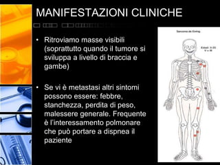 MANIFESTAZIONI CLINICHE
• Ritroviamo masse visibili
(soprattutto quando il tumore si
sviluppa a livello di braccia e
gambe...