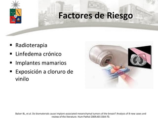 Factores	
  de	
  Riesgo	
  
	
  
§  Radioterapia	
  
§  Linfedema	
  crónico	
  
§  Implantes	
  mamarios	
  
§  Exposición	
  a	
  cloruro	
  de	
  
vinilo	
  
	
  
Balzer	
  BL,	
  et	
  al.	
  Do	
  biomaterials	
  cause	
  implant-­‐associated	
  mesenchymal	
  tumors	
  of	
  the	
  breast?	
  Analysis	
  of	
  8	
  new	
  cases	
  and	
  
review	
  of	
  the	
  literature.	
  Hum	
  Pathol	
  2009;40:1564-­‐70.	
  
 