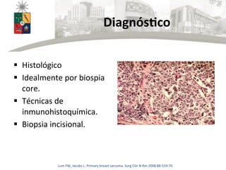 Diagnós>co	
  
§  Histológico	
  
§  Idealmente	
  por	
  biospia	
  
core.	
  
§  Técnicas	
  de	
  
inmunohistoquímica.	
  
§  Biopsia	
  incisional.	
  
	
   Lum	
  YW,	
  Jacobs	
  L.	
  Primary	
  breast	
  sarcoma.	
  Surg	
  Clin	
  N	
  Am	
  2008;88:559-­‐70.	
  
 