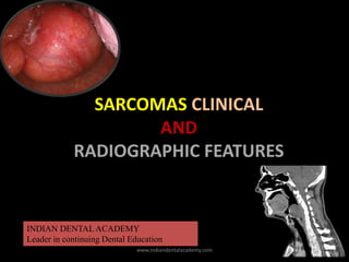 SARCOMAS CLINICAL
AND
RADIOGRAPHIC FEATURES
INDIAN DENTAL ACADEMY
Leader in continuing Dental Education
www.indiandentalacademy.com
 