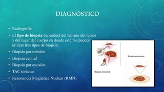 DIAGNÓSTICO
• Radiografía
• El tipo de biopsia dependerá del tamaño del tumor
y del lugar del cuerpo en donde esté. Se pueden
utilizar tres tipos de biopsia:
• Biopsia por incisión
• Biopsia central
• Biopsia por escisión
• TAC torácico
• Resonancia Magnética Nuclear (RMN)
 