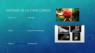 DEPENDE DE LA ETAPA CLÍNICA
• Etapa: 1 y 2 quirúrgico
• Etapa: 3 cirugía mas radioterapia
• Etapa: 4 quimioterapia
 