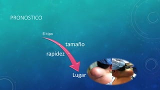 PRONOSTICO
El tipo
tamaño
rapidez
Lugar
 