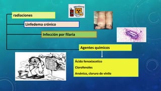 radiaciones
Linfedema crónico
Infección por filaria
Agentes químicos
Ácido fenoxiacetico
Clorofenoles
Arsénico, cloruro de vinilo
 
