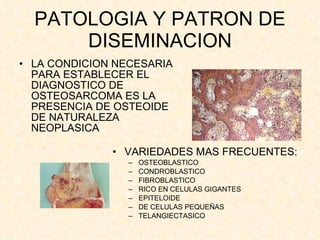 PATOLOGIA Y PATRON DE DISEMINACION LA CONDICION NECESARIA PARA ESTABLECER EL DIAGNOSTICO DE OSTEOSARCOMA ES LA PRESENCIA DE OSTEOIDE DE NATURALEZA NEOPLASICA VARIEDADES MAS FRECUENTES: OSTEOBLASTICO CONDROBLASTICO FIBROBLASTICO RICO EN CELULAS GIGANTES EPITELOIDE DE CELULAS PEQUEÑAS TELANGIECTASICO 