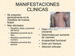 MANIFESTACIONES CLINICAS Se presenta generalmente en la metafisis de huesos largos Mas afectados  Metafisis distal y proximal del femur Metafisis proximal de la tibia Metafisis proximal del humero Metafisis proximal del perone Dolor de intensidad creciente Deformidad por aumento de volumen Incapacidad funcional Dolor por fractura Afeccion articular 