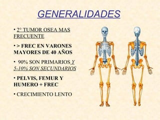 GENERALIDADES 2° TUMOR OSEA MAS FRECUENTE > FREC EN VARONES MAYORES DE 40 AÑOS   90% SON PRIMARIOS  Y 5-10% SON SECUNDARIOS PELVIS, FEMUR Y HUMERO + FREC CRECIMIENTO LENTO 