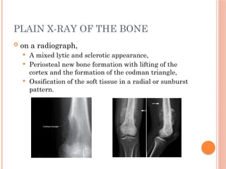 Comprehensive Overview of Soft Tissue, Retroperitoneal, and Bone ...