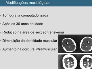 Modificações morfológicas
• Tomografia computadorizada
• Após os 30 anos de idade
• Redução na área de secção transversa
• Diminuição da densidade muscular
• Aumento na gordura intramuscular
 