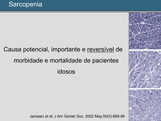 Causa potencial, importante e reversível de
morbidade e mortalidade de pacientes
idosos
Janssen et al: J Am Geriatr Soc. 2002 May;50(5):889-96
Sarcopenia
 