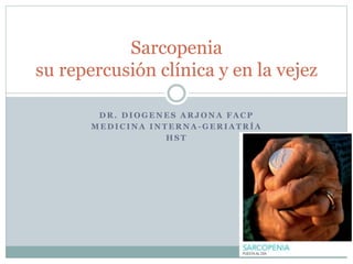 Sarcopenia 
su repercusión clínica y en la vejez 
DR. DIOGENES ARJONA FACP 
MEDICINA INTERNA-GERIATRÍA 
HST 
 