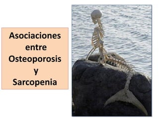Asociaciones
entre
Osteoporosis
y
Sarcopenia
 