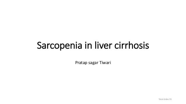 Sarcopenia In Liver Cirrhosis
