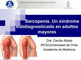 Sarcopenia. Un sindrome
subdiagnosticado en adultos
mayores
Dra. Cecilia Albala
INTA/Universidad de Chile
Academia de Medicina
 