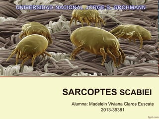 Alumna: Madelein Viviana Claros Euscate
2013-39381
SARCOPTES SCABIEI
 
