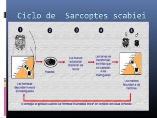 Ciclo de Sarcoptes scabiei
 