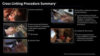 Sarezky keratoconusupdate | PPTX