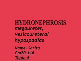 megaureter,
vesicoureteral
hypospadias
Name- Sarita
Gm20-116
Topic-4
 