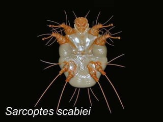 Sarcoptes scabiei 