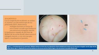 Piyoderma sarna.pptx