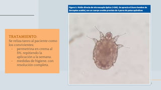 16
TRATAMIENTO:
Se reliza tanro al paciente como
los convivientes;
- permetrina en crema al
5%, repitiendo la
aplicación a la semana.
- medidas de higiene, con
resolución completa.
 