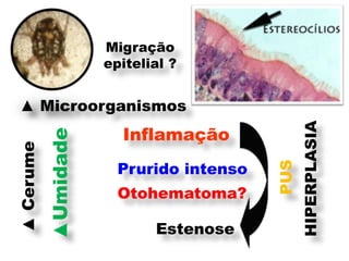 Migração
                      epitelial ?


 ▲ Microorganismos




                                                HIPERPLASIA
                        Inflamação
           ▲Umidade
▲ Cerume




                        Prurido intenso




                                          PUS
                        Otohematoma?

                             Estenose
 
