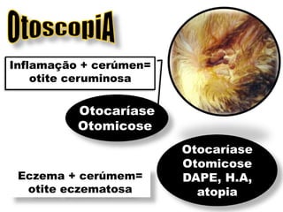 Inflamação + cerúmen=
    otite ceruminosa


          Otocaríase
          Otomicose
                        Otocaríase
                        Otomicose
 Eczema + cerúmem=      DAPE, H.A,
  otite eczematosa        atopia
 
