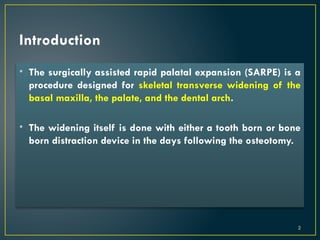 Surgical assisted Rapad Palatal Expansion | PPTX