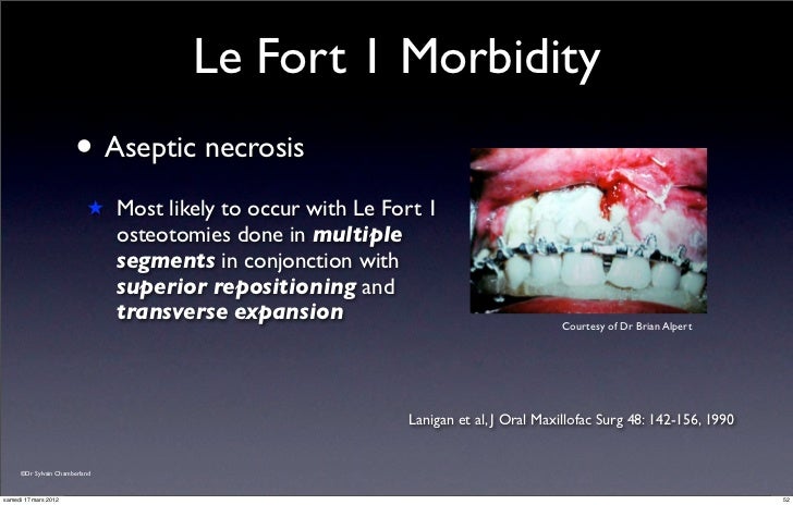 lefort osteotomies