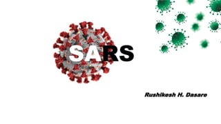 Rushikesh H. Dasare
SARS
 