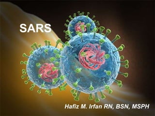 SARS
Hafiz M. Irfan RN, BSN, MSPH
 