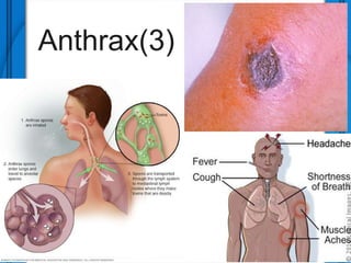 Anthrax(3)
 