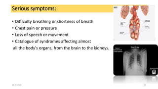 Serious symptoms:
• Difficulty breathing or shortness of breath
• Chest pain or pressure
• Loss of speech or movement
• Catalogue of syndromes affecting almost
all the body's organs, from the brain to the kidneys.
28-05-2020 29
 