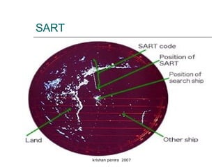 SART 
