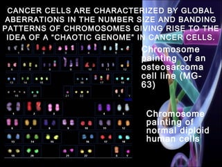 CANCER CELLS ARE CHARACTERIZED BY GLOBAL
ABERRATIONS IN THE NUMBER SIZE AND BANDING
PATTERNS OF CHROMOSOMES GIVING RISE TO THE
IDEA OF A “CHAOTIC GENOME” IN CANCER CELLS.
Chromosome
painting of
normal diploid
human cells
Chromosome
painting of an
osteosarcoma
cell line (MG-
63)
 