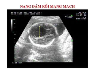 NANG ÑAÙM ROÁI MAÏNG MAÏCH
 