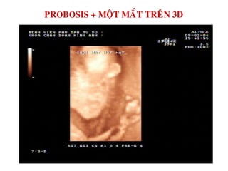 PROBOSIS + MOÄT MAÉT TREÂN 3D
 
