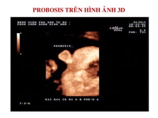 PROBOSIS TREÂN HÌNH AÛNH 3D
 