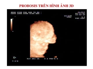 PROBOSIS TREÂN HÌNH AÛNH 3D
 