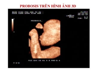 PROBOSIS TREÂN HÌNH AÛNH 3D
 