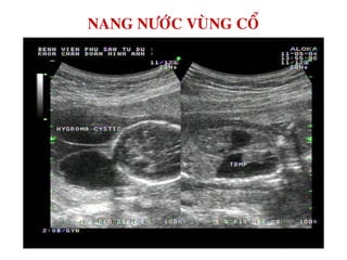 NANG NÖÔÙC VUØNG COÅ
 