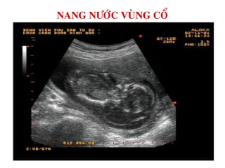 NANG NÖÔÙC VUØNG COÅ
 