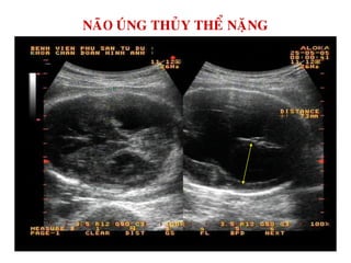 NAÕO UÙNG THUÛY THEÅ NAËNG
 