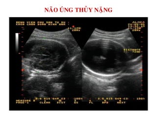 NAÕO UÙNG THUÛY NAËNG
 