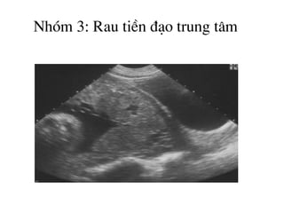 Nhãm 3: Rau tiÒn ®¹o trung t©m
 